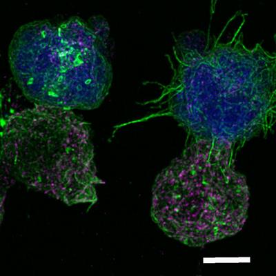 Editorial: Structure and function of the immunological and redirecting artificial synapses and their clinical implications